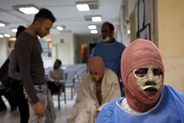 فوت 3 نفر در رابطه با حوادث چهارشنبه سوری، 227 مصدوم فوت 3 نفر در رابطه با حوادث چهارشنبه سوری، 227 مصدوم
