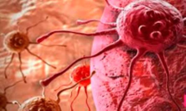 سرطان چگونه در بدن توسعه پیدا می نماید؟