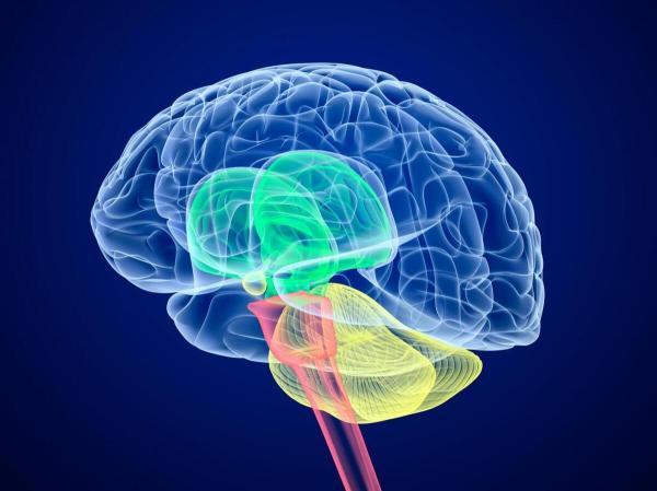 فلج مغزی چیست و چه نشانه هایی دارد؟